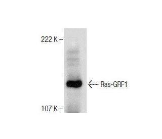 western blotting image from recommended Ras-GRF1 (D-12) monoclonal antibody replacement. Image 282566