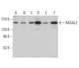 RASAL2 Antibody (B-11) - Western Blotting - Image 382609 