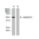 RASGEF1C Antibody (6E12) - Western Blotting - Image 33583