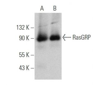 RasGRP1 Antibody (199) - Western Blotting - Image 360672 