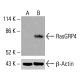 RasGRP4 Antibody (E-2) - Western Blotting - Image 416029