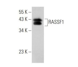RASSF1 Antibody (3F3) - Western Blotting - Image 40024