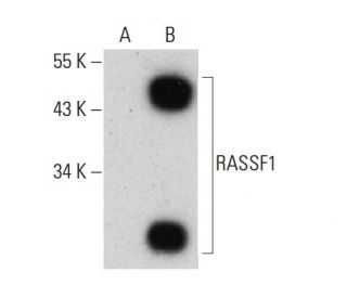 western blotting image from recommended RASSF1 (A-2) monoclonal antibody replacement. Image 384671