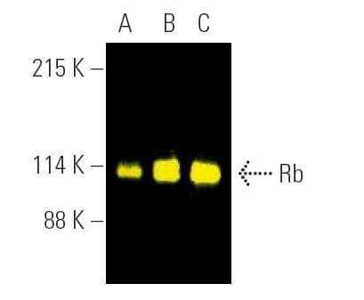 Rb Antibody (IF8) | SCBT - Santa Cruz Biotechnology
