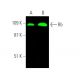 Dieser polyklonale Antikörper wird nicht mehr hergestellt. Wir empfehlen Ihnen unseren <a href="rb-antibody-if8">Rb (IF8)</a> monoklonalen Antikörper (Beispielsdaten werden angezeigt). western blotting image from recommended Rb (IF8) monoclonal antibody replacement. Image 372631