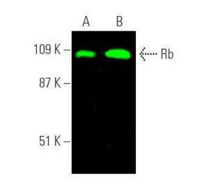 western blotting image from recommended Rb (IF8) monoclonal antibody replacement. Image 372631