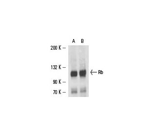 Rb Antibody (XZ55) | SCBT - Santa Cruz Biotechnology
