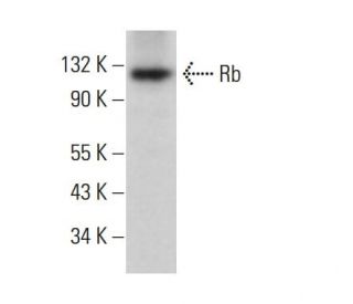 Rb Antibody (XZ55) | SCBT - Santa Cruz Biotechnology
