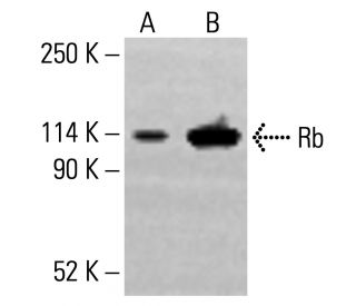 Rb Antibody (XZ55) | SCBT - Santa Cruz Biotechnology