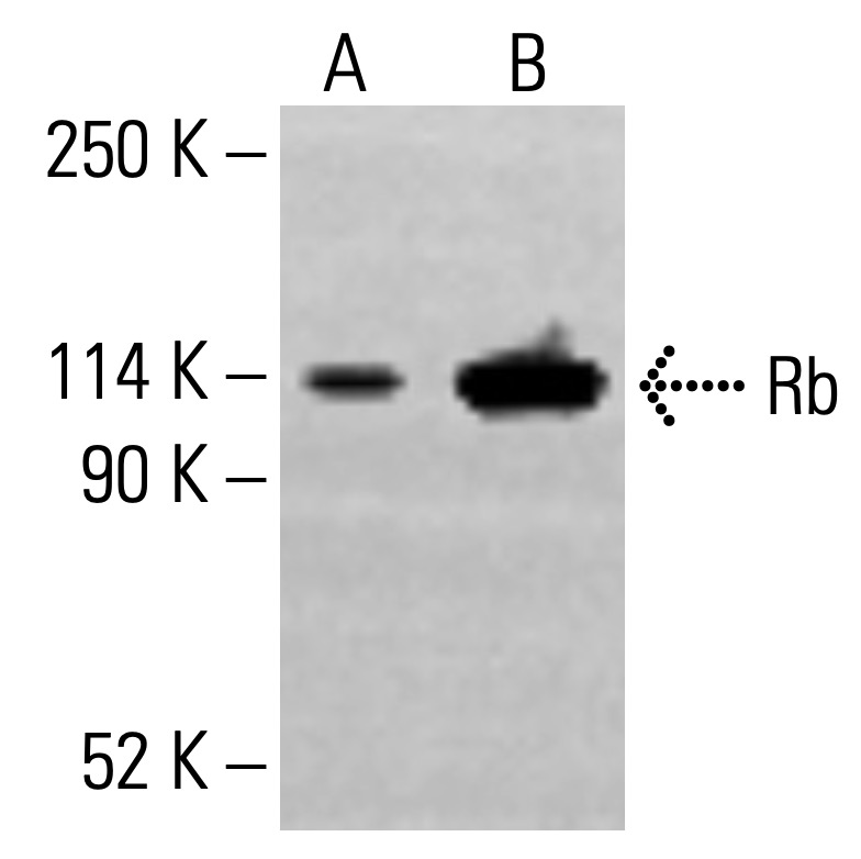 Rb Antibody (XZ55) | SCBT - Santa Cruz Biotechnology