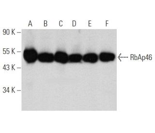 RbAp46 Antibody (E-9) - Western Blotting - Image 360620Each CRISPR/Cas9 Knockout (KO) Plasmid product consists of a pool of 3 plasmids designed to ensure identification and cleavage of a specific gene for maximum knockout efficiency. Each plasmid encodes a unique 20 nt sequence derived from the GeCKO (v2) library.