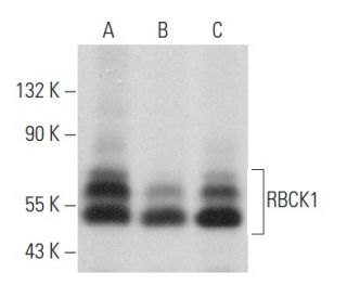 RBCK1 Antibody (H-1) - Western Blotting - Image 358036 