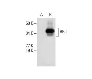 RBJ Antibody (E-2) - Western Blotting - Image 289738 