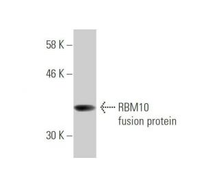 RBM10 Antibody (2F12) - Western Blotting - Image 348892