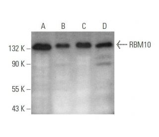 RBM10 Antibody (H-4) - Western Blotting - Image 350835 