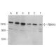 RBM10 Antibody (H-4) - Western Blotting - Image 379185