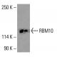 RBM10 Antibody (H-4) - Western Blotting - Image 416024