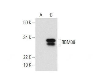 RBM24/38 Antibody (G-6) - Western Blotting - Image 292106Each CRISPR/Cas9 Knockout (KO) Plasmid product consists of a pool of 3 plasmids designed to ensure identification and cleavage of a specific gene for maximum knockout efficiency. Each plasmid encodes a unique 20 nt sequence derived from the GeCKO (v2) library.
