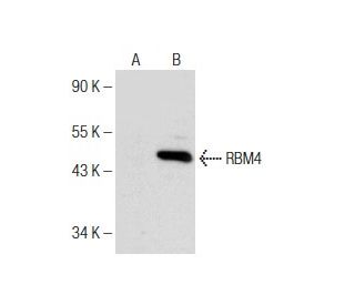 RBM4 Antibody (E-3) - Western Blotting - Image 150968SAM Transcription Activation: SAM system utilizing dCas9-VP64, MS2-P65-HSF1, and sgRNA for precise gene transcription activation.