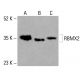 RBMX2 Antibody (C-1) - Western Blotting - Image 416502