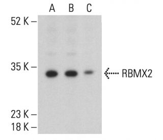 RBMX2 Antibody (C-1) - Western Blotting - Image 401852The Double Nickase Plasmid features a U6 promoter for sgRNA expression, a 20 nt targeting sequence, and a gRNA scaffold to guide Cas9n. It includes a CBh promoter for Cas9n (D10A) and puromycin resistance, GFP for transfection verification, and nuclear localization signals (NLS). The 2A peptide allows co-expression of Cas9n and Puro from a single promoter, enabling precise genome editing with reduced off-target effects. 