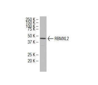 RBMXL2 Antibody (RR-17) - Western Blotting - Image 34495SAM Transcription Activation: SAM system utilizing dCas9-VP64, MS2-P65-HSF1, and sgRNA for precise gene transcription activation.