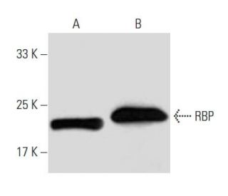 RBP Antibody (20F9) - Western Blotting - Image 62795