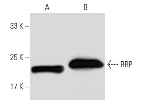 Fairpoint Rbp RBP Antibody (20F9) | SCBT - Santa Cruz Biotechnology