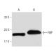 RBP Antibody (20F9) - Western Blotting - Image 62795