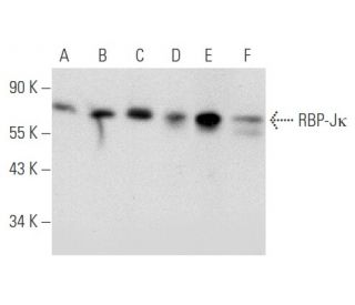 western blotting image from recommended RBP-J&kappa; (E-7) monoclonal antibody replacement. Image 356583