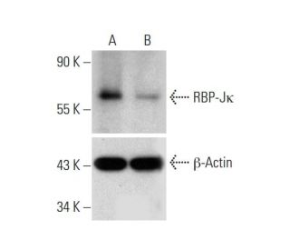 RBP-Jk Double Nickase Plasmid (h): sc-401373-NIC. Western blot analysis of RBP-Jk expression in non-transfected control (A 