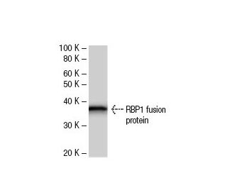 RBP1 Antibody (112C4a) - Western Blotting - Image 47951 