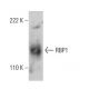 RBP1 Antibody (112C4a) - Western Blotting - Image 385141