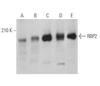 RBP2 Antibody (G-12) - Western Blotting - Image 359024SAM Transcription Activation: SAM system utilizing dCas9-VP64, MS2-P65-HSF1, and sgRNA for precise gene transcription activation.