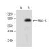 RBQ-3 Antibody (A-8) - Western Blotting - Image 150985 