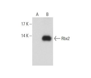 western blotting image from recommended Rbx2 (G-8) monoclonal antibody replacement. Image 128583