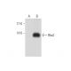 western blotting image from recommended Rbx2 (G-8) monoclonal antibody replacement. Image 128583