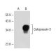 RCAN2/3 Antibody (B-9) - Western Blotting - Image 150649