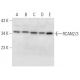 RCAN2/3 Antibody (B-9) - Western Blotting - Image 301361 