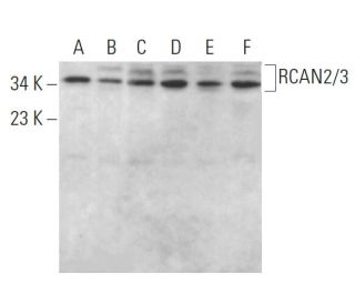 RCAN2/3 Antibody (B-9) - Western Blotting - Image 385298 