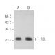RCL Antibody (A-7) - Western Blotting - Image 374006