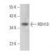 RDH10 Antibody (F-6) - Western Blotting - Image 373269