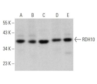 RDH10 Antibody (F-6) - Western Blotting - Image 373227SAM Transcription Activation: SAM system utilizing dCas9-VP64, MS2-P65-HSF1, and sgRNA for precise gene transcription activation.