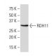 RDH11 Antibody (EE-12) - Western Blotting - Image 33961