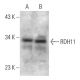RDH11 Antibody (F-1) - Western Blotting - Image 369356