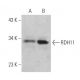 RDH11 Antibody (F-1) - Western Blotting - Image 369360 