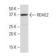 RDHE2 Antibody (36-N) - Western Blotting - Image 33964 