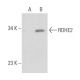 RDHE2 Antibody (36-N) - Western Blotting - Image 35057