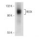 RECK Antibody (G-4) - Western Blotting - Image 147185 