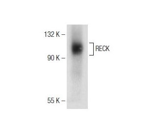 western blotting image from recommended RECK (G-4) monoclonal antibody replacement. Image 147185